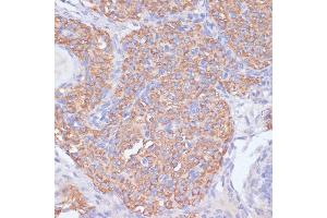 Immunohistochemistry of paraffin-embedded rat ovary using PI3 Kinase p85 beta antibody (ABIN7269320) at dilution of 1:200 (40x lens). (PIK3R2 antibody)