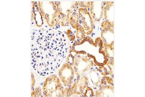 Immunohistochemical analysis of paraffin-embedded H. (BIM antibody  (Middle Region))