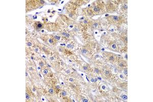 Immunohistochemistry of paraffin-embedded human liver injury using DPP3 antibody. (DPP3 antibody)