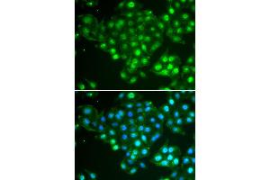 Immunofluorescence analysis of HeLa cells using ABCA3 antibody (ABIN5974136).