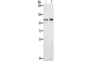 Western Blotting (WB) image for anti-Outer Dense Fiber of Sperm Tails 2 (ODF2) antibody (ABIN2430582) (ODF2 antibody)