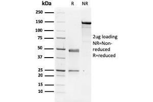 SDS-PAGE Analysis Purified NME1 / nm23-H1 Mouse Monoclonal Antibody (CPTC-NME1-2). (NME1 antibody)