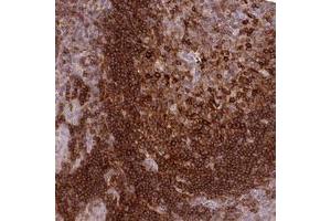 Immunohistochemical staining (Formalin-fixed paraffin-embedded sections) of human tonsil with CXCR5 polyclonal antibody  shows strong cytoplasmic positivity in germinal center cells and non-germinal center cells. (CXCR5 antibody)