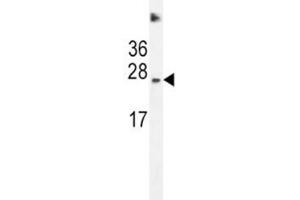 SDHD antibody western blot analysis in HeLa lysate (SDHD antibody  (AA 13-42))