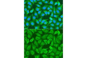Immunofluorescence analysis of A549 cell using RRM1 antibody. (RRM1 antibody)