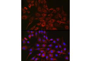 Immunofluorescence analysis of NIH/3T3 cells using P4H Rabbit pAb (ABIN1681193, ABIN3018745, ABIN3018746 and ABIN6220566) at dilution of 1:50 (40x lens). (P4HA2 antibody  (AA 234-533))