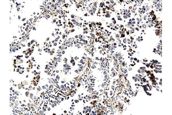 Cytokeratin 7 antibody  (AA 251-350)