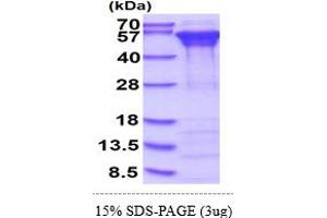 SDS-PAGE (SDS) image for Calreticulin (CALR) (AA 18-417) protein (His tag) (ABIN667783)