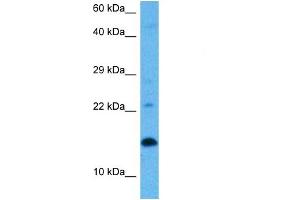 Host:  Rat  Target Name:  UBE2D1  Sample Tissue:  Rat Skeletal Muscle  Antibody Dilution:  1ug/ml (UBE2D1 antibody  (Middle Region))