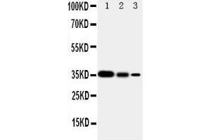 Western Blotting (WB) image for anti-SMAD, Mothers Against DPP Homolog 2 (SMAD2) (AA 94-112), (N-Term) antibody (ABIN3044112)