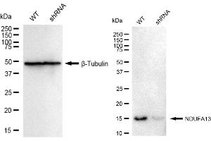 Western blotting analysis using NDUFA13 antibody (ABIN7799542).