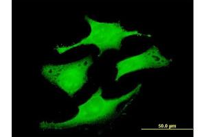 Immunofluorescence of purified MaxPab antibody to RAB6IP1 on HeLa cell. (DENND5A antibody  (AA 1-1287))