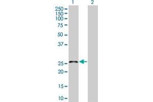 Lane 1: CACNG1 transfected lysate ( 25 KDa) Lane 2: Non-transfected lysate. (CACNG1 293T Cell Transient Overexpression Lysate(Denatured))