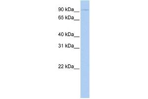 WB Suggested Anti-TSHR Antibody Titration:  0. (TSH receptor antibody  (N-Term))
