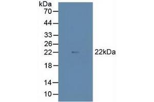 Figure. (MAX antibody  (AA 2-160))