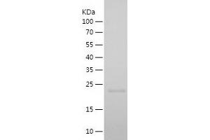 Western Blotting (WB) image for Cyclin A1 (CCNA1) (AA 18-172) protein (His tag) (ABIN7282334) (Cyclin A1 Protein (CCNA1) (AA 18-172) (His tag))