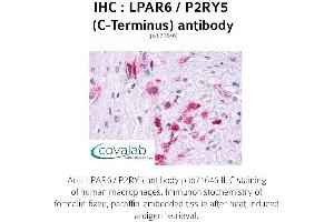 Image no. 1 for anti-Lysophosphatidic Acid Receptor 6 (LPAR6) (C-Term) antibody (ABIN1736532) (LPAR6 antibody  (C-Term))