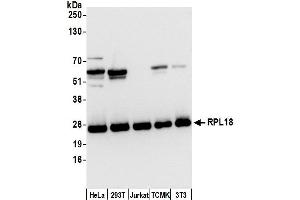 anti-Ribosomal Protein L18 (RPL18) (AA 138-188) antibody