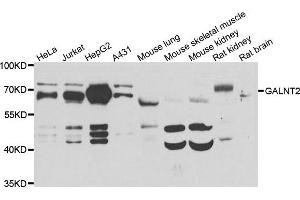 Western blot analysis of extracts of various cell lines, using GALNT2 antibody. (GALNT2 antibody)
