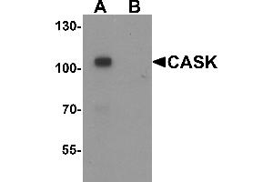 Western blot analysis of CASK in mouse brain tissue lysate with CASK antibody at 1 µg/mL in (A) the absence and (B) the presence of blocking peptide. (CASK antibody  (N-Term))