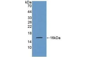 Detection of Recombinant SST, Rat using Polyclonal Antibody to Somatostatin (SST) (Somatostatin antibody  (AA 27-116))