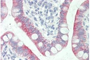 Human Small Intestine: Formalin-Fixed, Paraffin-Embedded (FFPE) (SLC41A1 antibody  (AA 36-85))