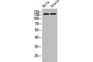 Western blot analysis of 1) Hela, 2) Mouse Brain, diluted at 1:4000. (ErbB2/Her2 antibody)