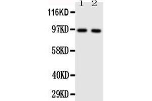 Anti-TLR4 antibody, Western blotting Lane 1: HELA Cell Lysate  Lane 2: SMMC Cell Lysate