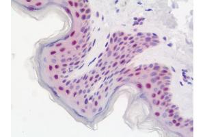 Anti-DDX39 / BAT1 antibody IHC staining of human skin. (DDX39 antibody  (AA 53-425))