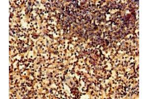 Immunohistochemistry of paraffin-embedded human spleen tissue using ABIN7169222 at dilution of 1:100 (WNK1 antibody  (AA 1-207))