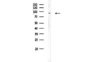 anti-Glycerol-3-Phosphate Acyltransferase 2, Mitochondrial (GPAT2) (Internal Region) antibody