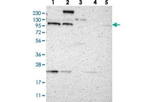 Western blot analysis of Lane 1: RT-4, Lane 2: U-251 MG, Lane 3: Human Plasma, Lane 4: Liver, Lane 5: Tonsil with TMF1 polyclonal antibody  at 1:250-1:500 dilution.