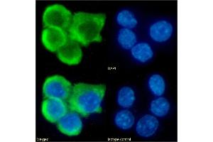 Immunofluorescence staining of fixed RAW264. (Recombinant CCR7 antibody)