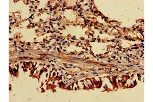 Immunohistochemistry of paraffin-embedded human lung tissue using ABIN7143158 at dilution of 1:100 (TRIP4 antibody  (AA 360-535))
