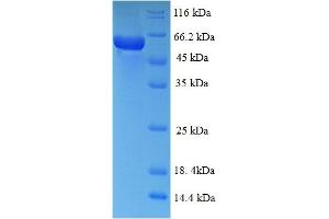 SDS-PAGE (SDS) image for Mitogen-Activated Protein Kinase 13 (MAPK13) (AA 1-365), (full length) protein (His-SUMO Tag) (ABIN5709903)