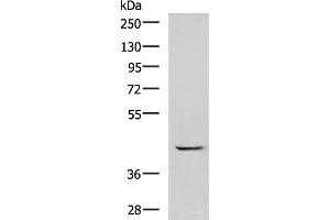 Western blot analysis of A549 cell lysate using GABPB1 Polyclonal Antibody at dilution of 1:1000 (GABPB1 antibody)