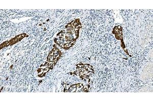 IHC analysis of Glycine decarboxylase/GLDC using anti-Glycine decarboxylase/GLDC antibody (ABIN7602073). (GLDC antibody  (AA 574-1020))