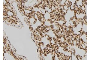 ABIN6275518 at 1/100 staining Rat lung tissue by IHC-P. (DVL2 antibody  (C-Term))