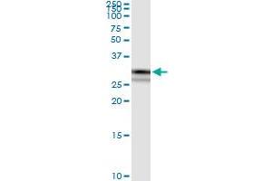 Immunoprecipitation of CRYZ transfected lysate using rabbit polyclonal anti-CRYZ and Protein A Magnetic Bead (CRYZ (Human) IP-WB Antibody Pair)