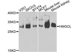 Western blot analysis of extracts of various cells, using HMGCL antibody. (HMGCL antibody)