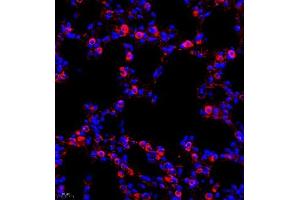 Immunofluorescence (IF) image for anti-Chloride Intracellular Channel 6 (CLIC6) antibody (ABIN7073478) (CLIC6 antibody)