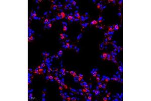 Immunofluorescence (IF) image for anti-Chloride Intracellular Channel 6 (CLIC6) antibody (ABIN7073478)