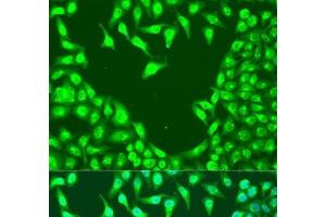 Immunofluorescence analysis of U2OS cells using MAP2K4 Polyclonal Antibody at dilution of 1:100.