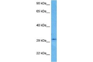 Host:  Rabbit  Target Name:  CBR3  Sample Tissue:  Human U937 Whole Cell lysates  Antibody Dilution:  1ug/ml