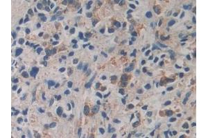 Immunohistochemistry (IHC) image for anti-Calcyclin Binding Protein (CACYBP) (AA 2-228) antibody (ABIN7434842)