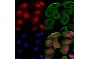 ABIN7094246 and ABIN7098293 staining Hela cells by IF/ICC.
