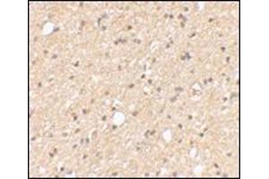 Immunohistochemical staining of human brain tissue using AP30499PU-N at 2. (LGI2 antibody  (Center))
