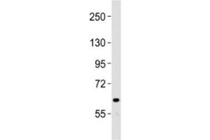 Western blot testing of NOTCH4 antibody at 1:2000 dilution + human liver lysate (NOTCH4 antibody  (C-Term))