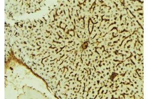 ABIN6279807 at 1/100 staining Mouse liver tissue by IHC-P.