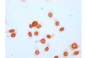 Immunocytochemistry analysis of ABIN7139170 diluted at 1:15 and staining in Hela cells (treated with 30mM sodium butyrate for 4h) performed on a Leica BondTM system. (Histone H2B antibody  (acLys20))